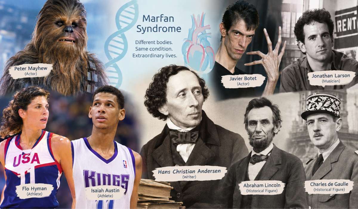 famous people with Marfan syndrome